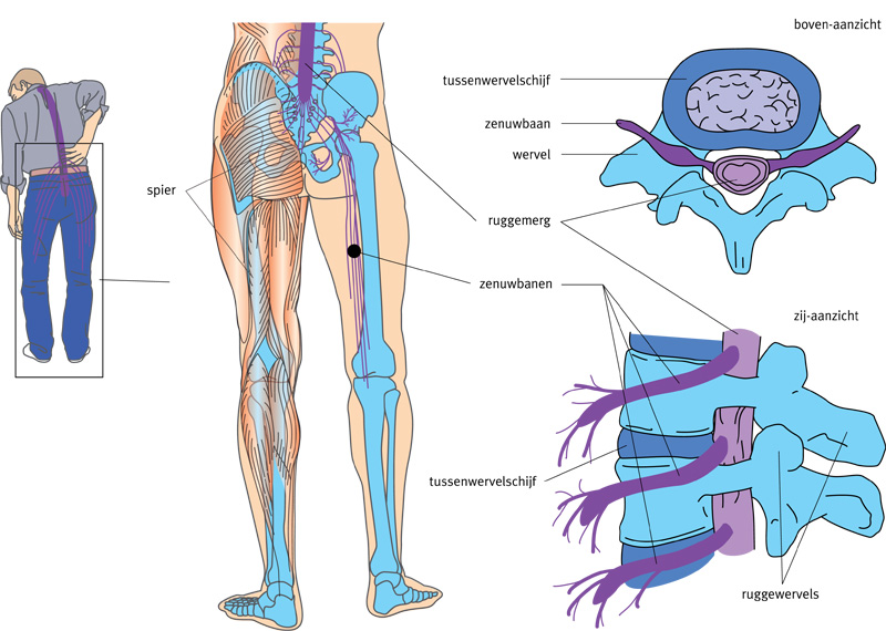 Afbeelding van de rug en zenuwen naar de benen